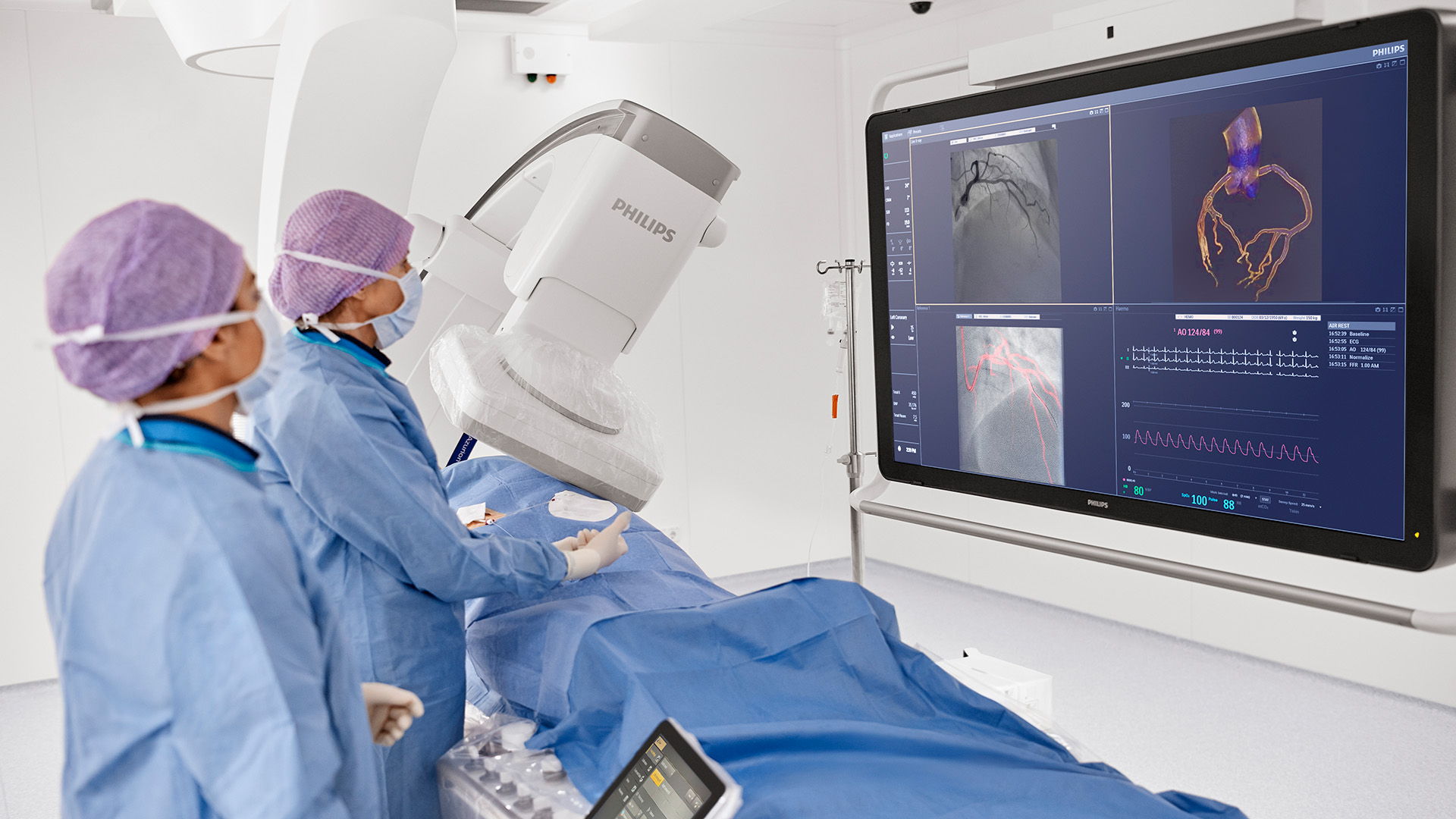 Philips introduces cath lab integration that automatically synchronizes pre-operative CT with C-arm movement, paving the way for CT-guided PCI